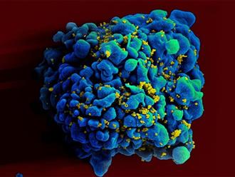 Anh tìm ra biến chủng HIV mới có khả năng lây nhiễm cao và gây ảnh hưởng nghiêm trọng tới sức khỏe