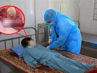 Nữ sinh 18 tuổi ở Nghệ An đã tử vong do bệnh bạch hầu: Xác định 119 trường hợp tiếp xúc, cảnh báo nguy cơ bùng dịch truyền nhiễm 